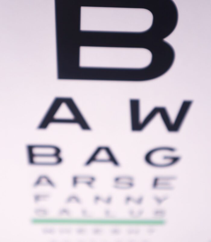 Funny Scottish Eye Test Close Up by Aff Yer Rocket Scottish Gifts